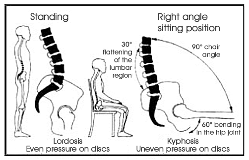 Lordosis and Kyphosis